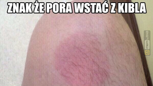 Śmieszny mem: 2887380 - MemLand