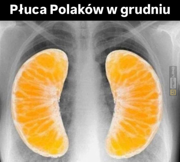 Śmieszny mem: 9206691 - MemLand